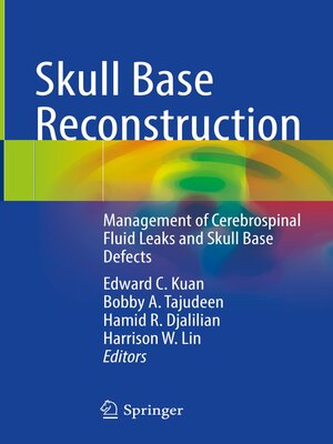 cover image of Skull Base Reconstruction